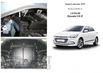   Hyundai I-20 2014- V-1,4 , ,   1.0704.00
